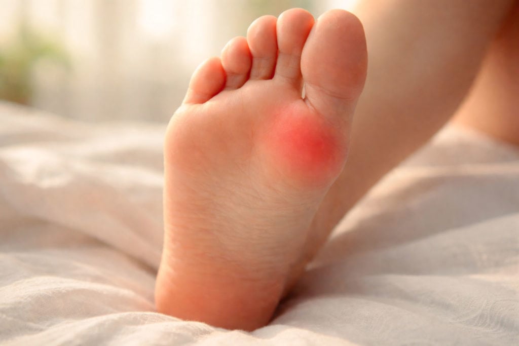 traitement des sesamoidites