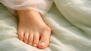 traitement chirurgical et conservateur de l'hallux valgus à Genève