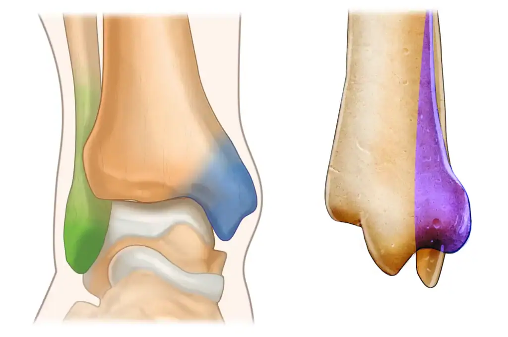 Anatomie des malléoles de la cheville