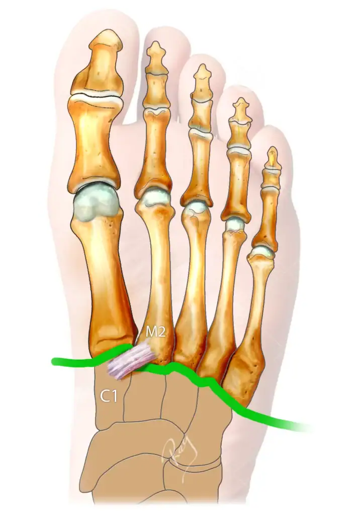 Anatomie de l'articulation du Lisfranc