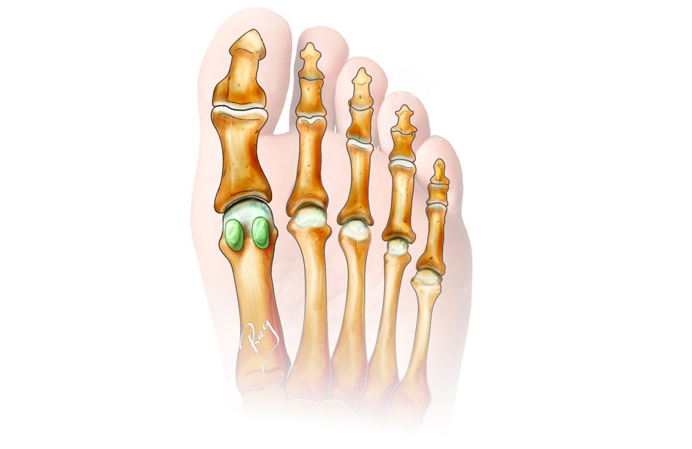 Anatomie des os sésamoïdes
